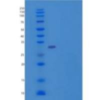 人自噬相关5同源物(ATG5)重组蛋白