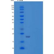 人蛋白磷酸酶1调节亚单位14A/PPP1R14A重组蛋白C-6His