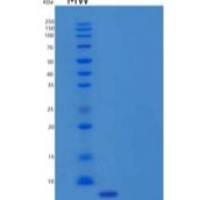 人防御素β1(DEFb1)重组蛋白