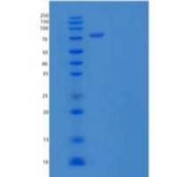 人凯尔奇样蛋白41/Kell/CD238重组蛋白C-6His