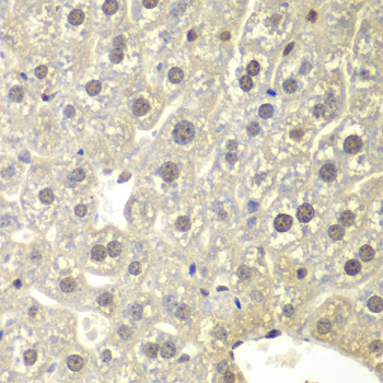 Anti-NR3C1 Polyclonal Antibody