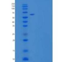 人羧酸酯酶1(CES1)重组蛋白C-6His