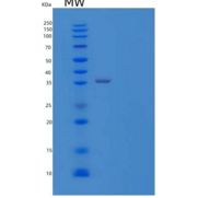 人β-1,4-半乳糖转移酶4(b4GALT4)重组蛋白C-6His