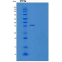 人β-1,4-半乳糖转移酶4(b4GALT4)重组蛋白C-6His