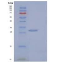 小鼠含V-Set免疫球蛋白域蛋白8(VSIG8)重组蛋白C-6His