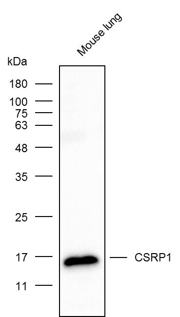 Anti-CSRP1 Polyclonal Antibody
