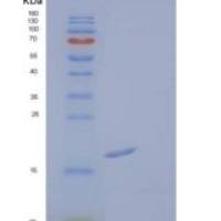 人成纤维细胞生长因子1/FGF-1/成纤维细胞生长因子重组蛋白