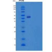 人抑制蛋白β1(ARRb1)重组蛋白C-6His