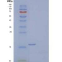 人视黄酸受体反应蛋白2/Chemerin/TIG2重组蛋白C-6His