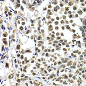Anti-IRF2 Polyclonal Antibody