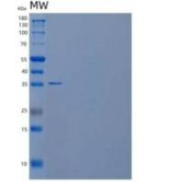 人核糖磷酸焦磷酸激酶2/PRPS2重组蛋白C-6His
