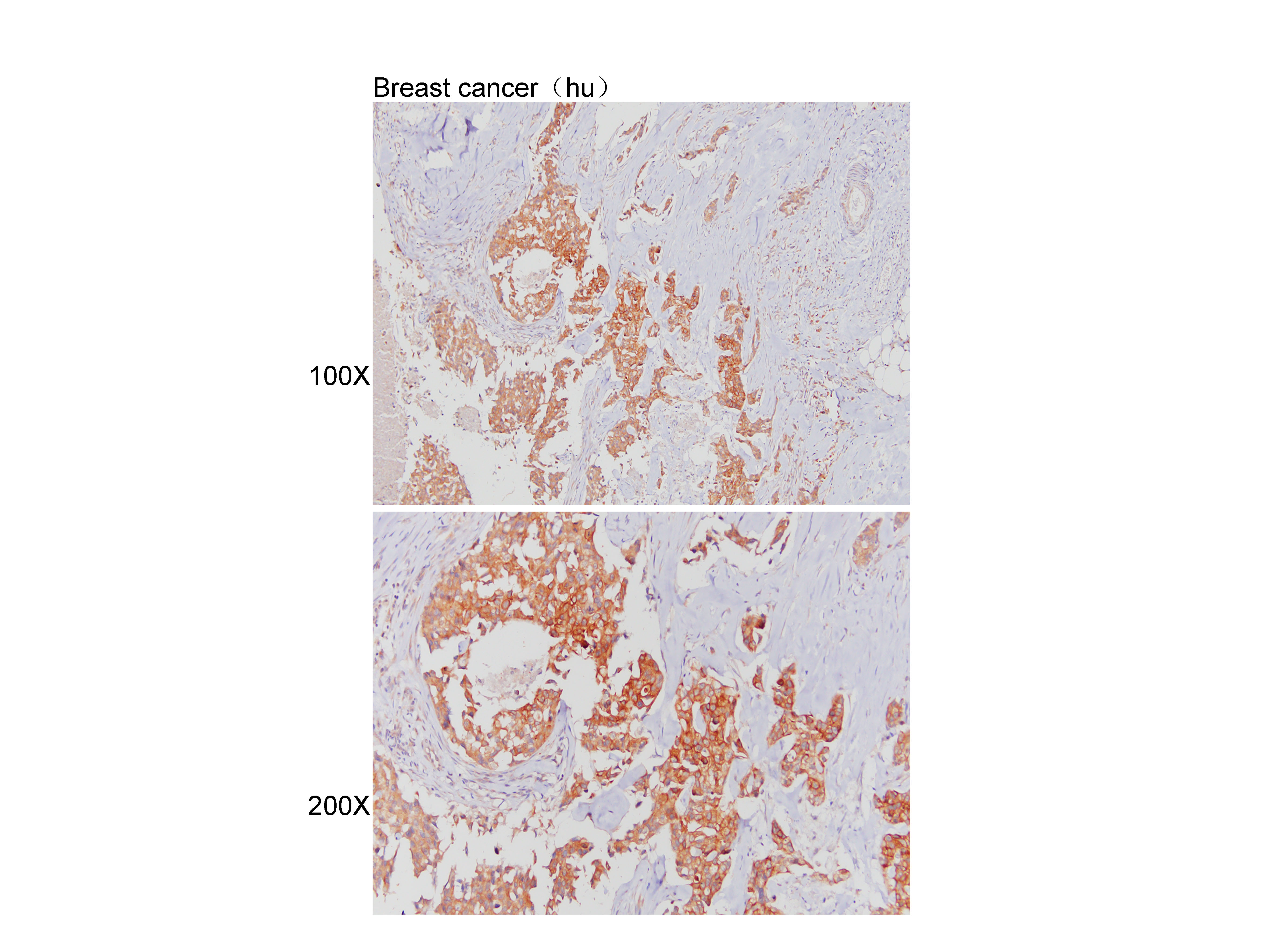 Anti-GPR143 Polyclonal Antibod