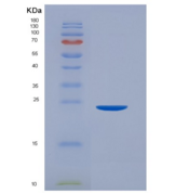 人CD32a / FCGR2A重组蛋白167 Arg, Hi