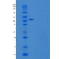 人Serpin I2重组蛋白C-6His