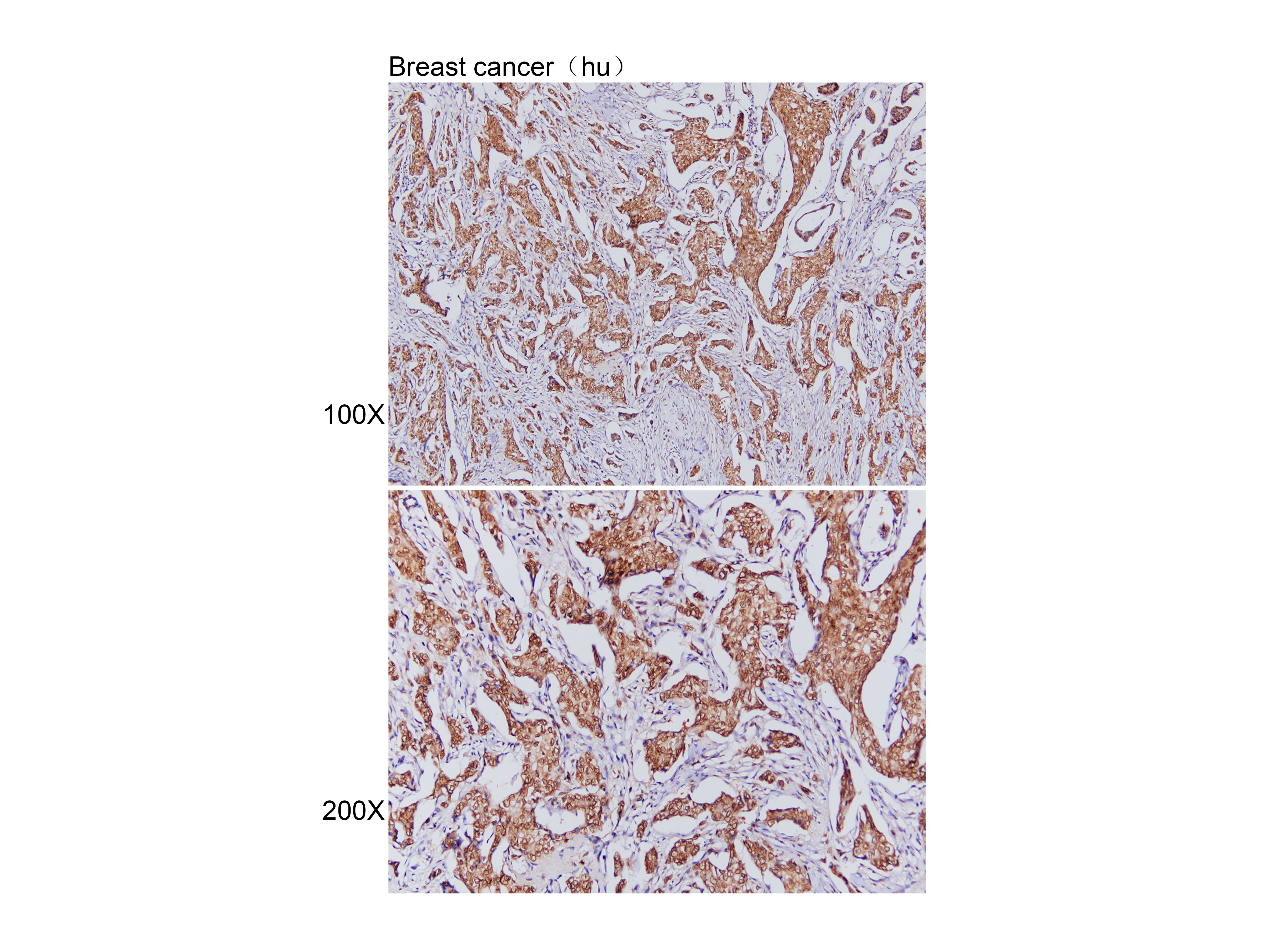 Anti-DFFA Polyclonal Antibody