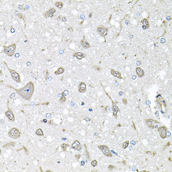 Anti-FGF1 Polyclonal Antibody