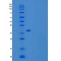 人Sentrin特异性蛋白酶7/SENP7重组蛋白N-6His