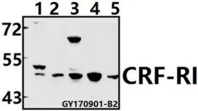 CRHR1 + CRHR2 antibody