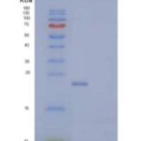 小鼠胸腺基质淋巴细胞生成素受体/TSP R重组蛋白C-6His