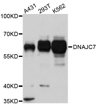 Anti-DNAJC7 Polyclonal Antibod
