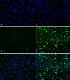 Human alpha Synuclein protein 