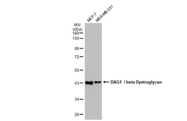 DAG1 / beta Dystroglycan antib
