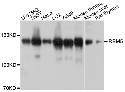 Anti-RBM5 Polyclonal Antibody
