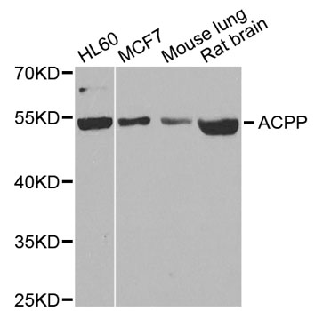 Anti-ACPP Polyclonal Antibody