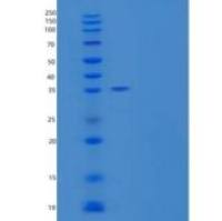 人蛋氨酸氨肽酶1D/MetAP1D/MAP1D重组蛋白N, C-6His