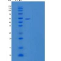 人Serpin A10/ZPI重组蛋白C-6His