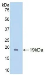 Mouse GDNF protein, His tag
