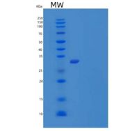 人酯酶D(ESD)重组蛋白C-6His