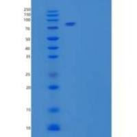 人低密度脂蛋白受体重组蛋白