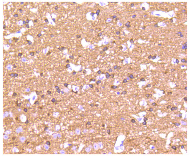 Tau Rabbit Monoclonal Antibody