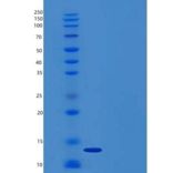 人GM-CSF/CSF2重组蛋白
