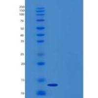 人GM-CSF/CSF2重组蛋白