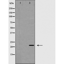 Claudin 4 antibody