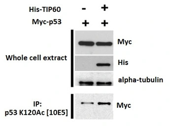 p53 (Acetyl Lys120) antibody [
