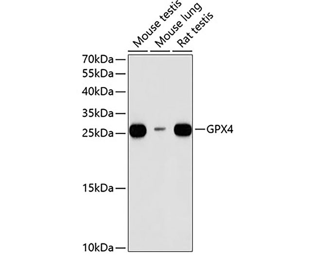 GPX4 Rabbit Polyclonal Antibod
