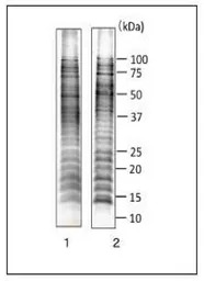 Salmonella enteritidis LPS ant