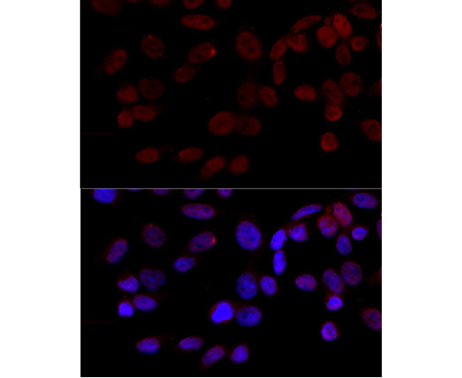 JNK1/MAPK8 Rabbit Polyclonal A