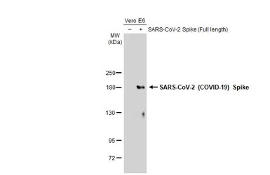 SARS-CoV-2 (COVID-19) Spike an