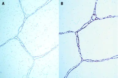Progesterone Receptor antibody