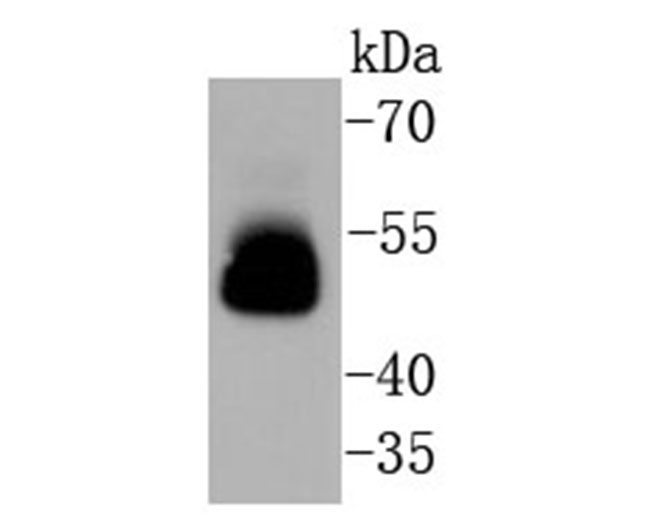 Tau Rabbit Monoclonal Antibody