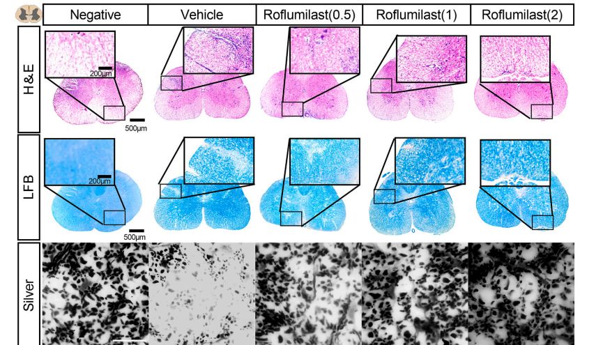 EAE模型 | 罗氟司特调节神经炎症，改善多发性硬化症(MS)的运动功能和抑郁症状
