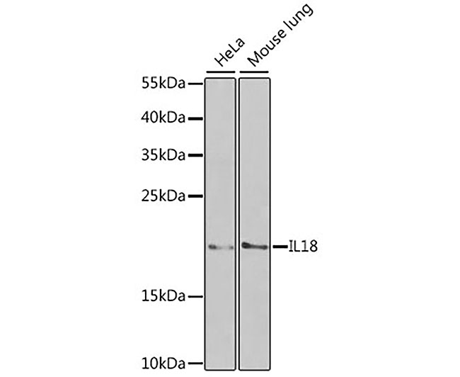 IL18 Rabbit Polyclonal Antibod