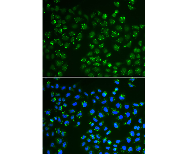 GPX4 Rabbit Polyclonal Antibod