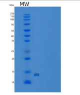 人R-脊椎蛋白1(RSPO1)重组蛋白aa 1-146, H