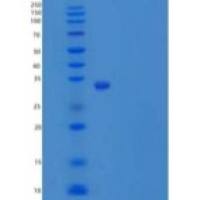 人HDHD2 重组蛋白N-6His