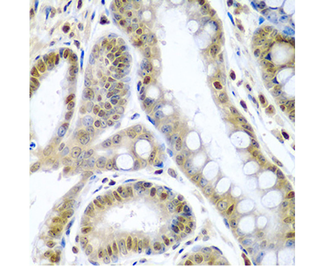 TNFSF10/TRAIL Rabbit Polyclona